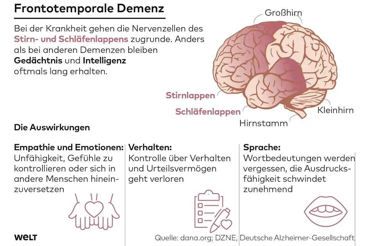 Frontotemporale Demenz erkennen und Angehörige entlasten